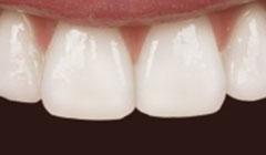 no gap after