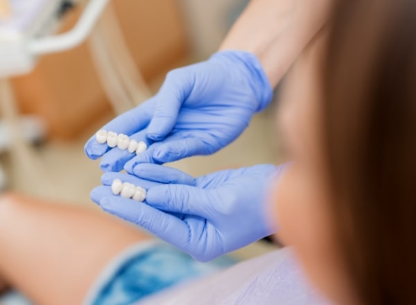 Dentist showing patient dental bridge restorations