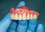 A gloved hand holding an upper denture