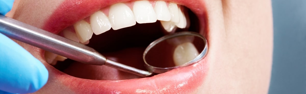Dentist examining smile after placing tooth colored fillings