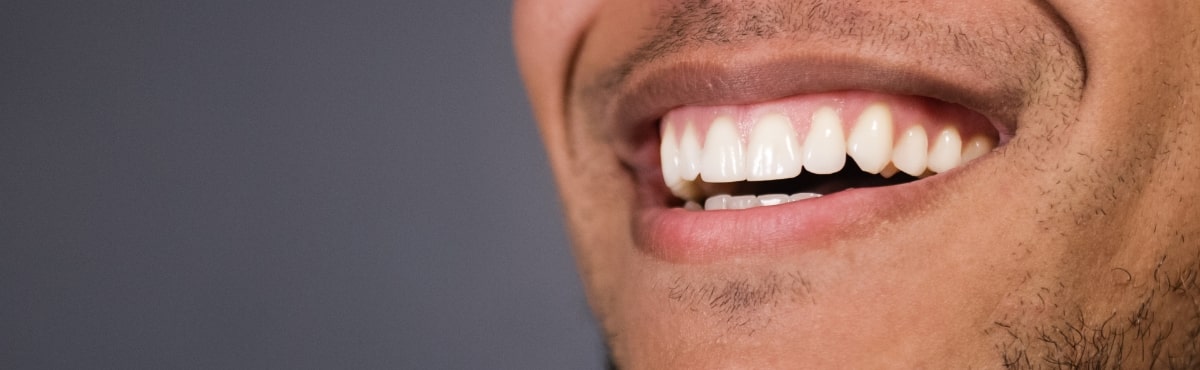 Closeup of healthy smile after gum disease therapy