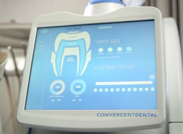 Solea laser dentistry treatment