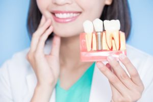 Smiling dentist holding model of dental implants in North Phoenix 