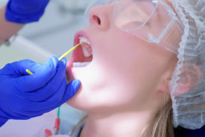 woman receiving fluoride treatment