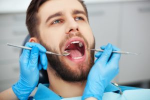 man with open mouth at dentist 