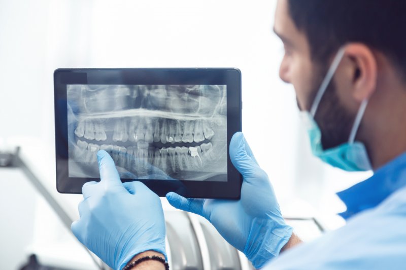 An emergency dentist looking over a patient's X-ray